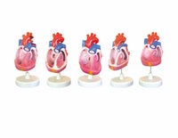 Modelo de malformación cardíaca congénita, simulador de entrenamiento médico de anatomía humana avanzada