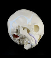 Craneo de bebe fetal feto