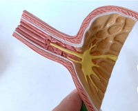 Modelo de estomago reflujo gastrico Patologia gastrica