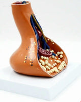 Modelo Aumento Sinapsis de Terminaciones Nerviosas