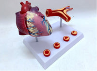 Modelo de corazon trombosis Vascular con arteria