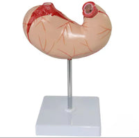 Modelo de estomago sano pared gastrica