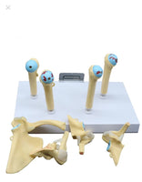 Modelo anatomico degeneracion de hombro osteoartritis