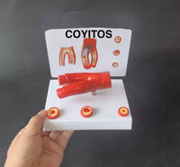 Modelo Arteriosclerosis arterias