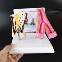 Modelo anatómico Arterias vasculares comparación aterosclerosis