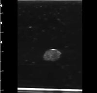 Simulador de puncion tumoral con biopsia vasos sanguíneos - ultrasonido