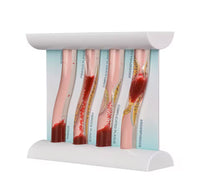 Simulador Arterial LDL colesterol obstruccion flujo sanguíneo