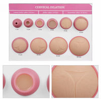 Modelo dilatación cervical