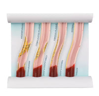 Simulador Arterial LDL colesterol obstruccion flujo sanguíneo