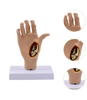 Modelo de Mano patologia tendon y ligamento osteoartritis