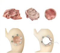 Simulador de Disección submucosa endoscópica ESD endoscopia