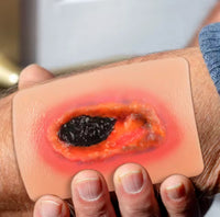 Modelo Kit de heridas necroticas