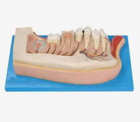 Modelo de dental dientes infantil mandíbula inferior niño de 12 años