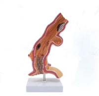 Modelo anatomico de esofago de Barrett patologias