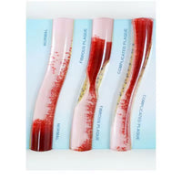 Simulador Arterial LDL colesterol obstruccion flujo sanguíneo