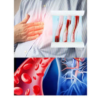 Simulador Arterial LDL colesterol obstruccion flujo sanguíneo