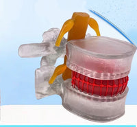Modelo de vertebra lumbar - hernia discal - Modelos Anatómicos Humanos