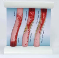 Simulador Arterial LDL colesterol obstruccion flujo sanguíneo