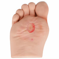 Modelo Pie Diabetico 5 Etapas