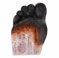 Modelo Pie Diabetico 5 Etapas