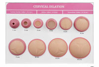 Modelo dilatación cervical