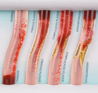 Simulador Arterial LDL colesterol obstruccion flujo sanguíneo