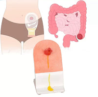 Simulador de ostomia colostomia urostomia