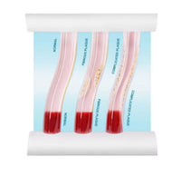 Simulador Arterial LDL colesterol obstruccion flujo sanguíneo