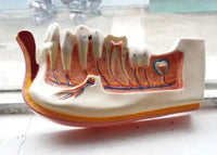 Modelo de dental dientes infantil mandíbula inferior niño de 12 años
