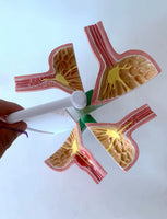 Modelo de estomago reflujo gastrico Patologia gastrica