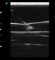 Simulador venopuncion yugular vena central guiada ultrasonido