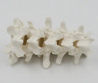 Modelo de anatomía 1:1 vértebra Lumbar cervical de 5 segmentos