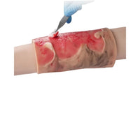 Kit de modelo de simulacion realista de quemaduras de segundo y tercer grado en extremidades