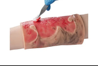 Kit de modelo de simulacion realista de quemaduras de segundo y tercer grado en extremidades