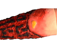 Kit de modelo de simulacion realista de quemaduras de segundo y tercer grado en extremidades