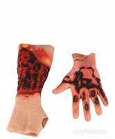 Kit de modelo de simulacion realista de quemaduras de segundo y tercer grado en extremidades