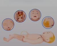 Modelo de venopunción cefalica y unbilical infantil nino