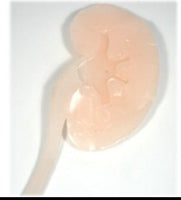 Simulador ultrasonido guiado punsion renal - biopsia