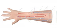 Simulador Ultrasonido Fistulas arteriovenosas brazo