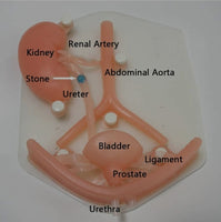 Simulador laparoscopia sistema urinario