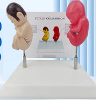 Modelo anatomico feto comparativo fumados Vs saludable