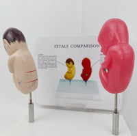 Modelo anatomico feto comparativo fumados Vs saludable