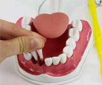 Modelo de demostración dental de dientes magnificada