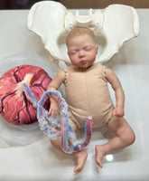 Anatomía de la Pelvis con cordón Umbilical del feto y placenta