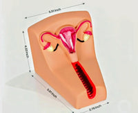 Modelo simulador de entrenamiento DIU aspiracion manual endouterina (AMEU)