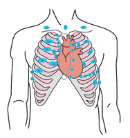 Simulador de auscultacion cardiopulmonar digital por control remoto