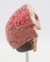 Modelo Cerebral Senil con patología