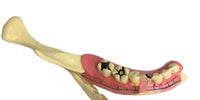 Modelo de descomposicion dental (mandibula derecha)