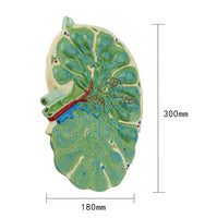 Modelo de agrandamiento de nódulos linfáticos humanos