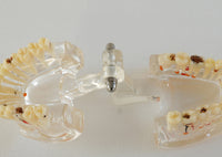 Modelo dental patologico completo